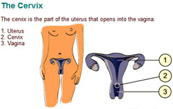 From the European Cervical Cancer Association's website - click the pic!