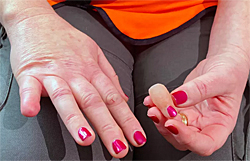 Image: Sarah King lost finger