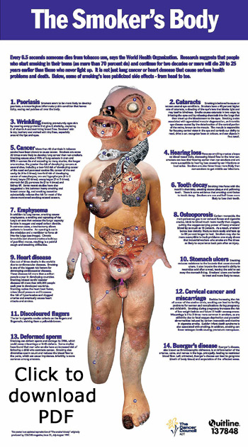Pic: Click to download poster in PDF